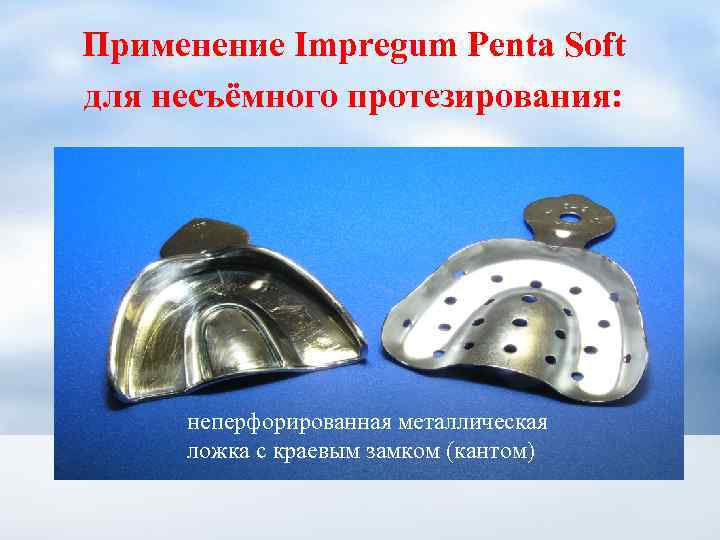 Применение Impregum Penta Soft для несъёмного протезирования: неперфорированная металлическая ложка с краевым замком (кантом)
