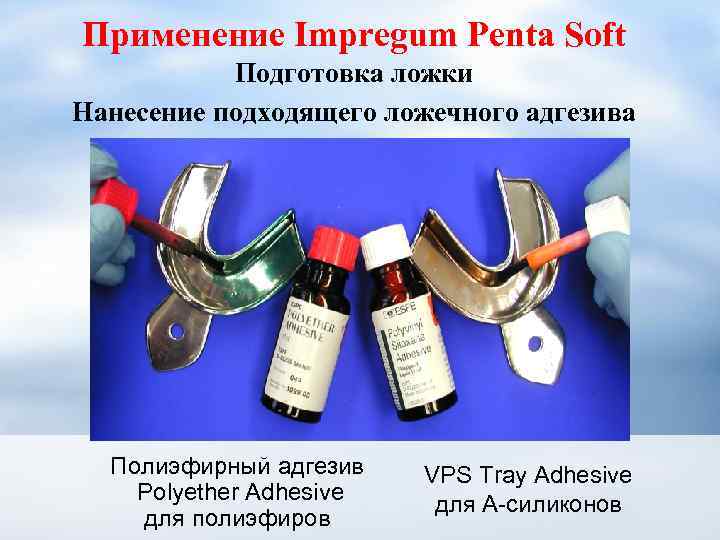 Применение Impregum Penta Soft Подготовка ложки Нанесение подходящего ложечного адгезива Полиэфирный адгезив Polyether Adhesive