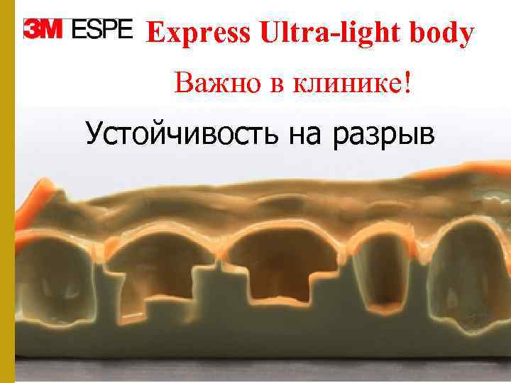Express Ultra-light body Важно в клинике! Устойчивость на разрыв 