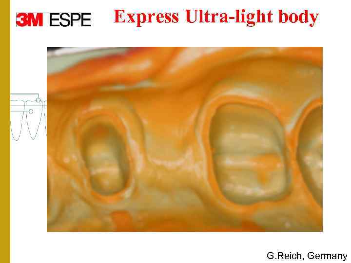 Express Ultra-light body G. Reich, Germany 
