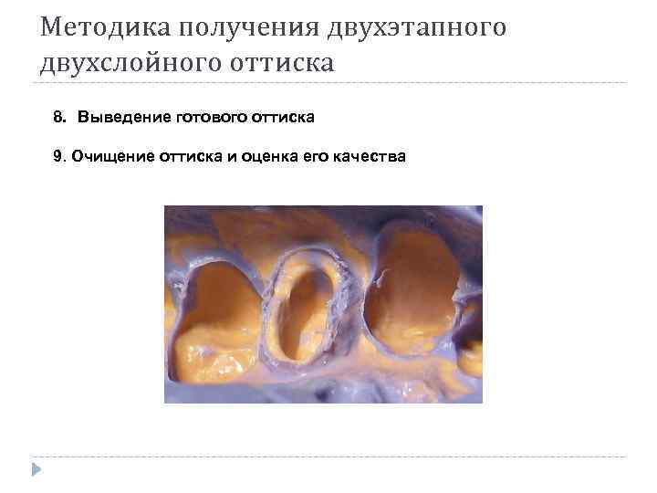 Методика получения двухэтапного двухслойного оттиска 8. Выведение готового оттиска 9. Очищение оттиска и оценка