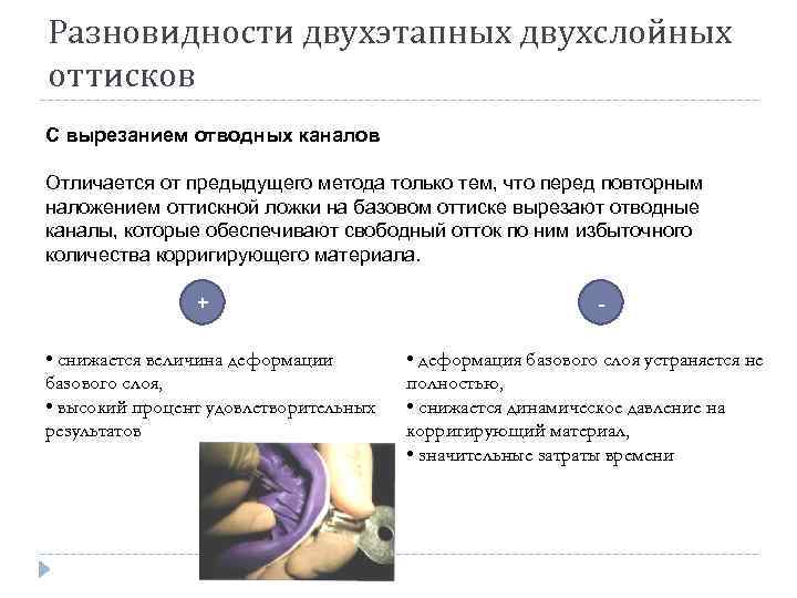 Разновидности двухэтапных двухслойных оттисков С вырезанием отводных каналов Отличается от предыдущего метода только тем,