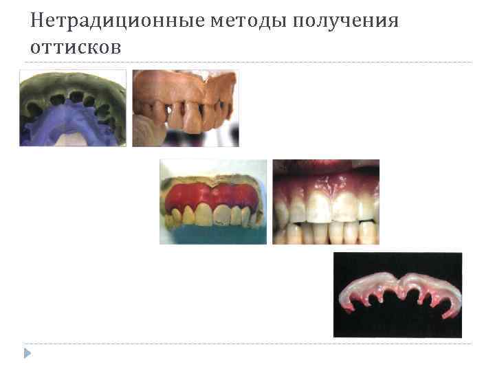 Нетрадиционные методы получения оттисков 