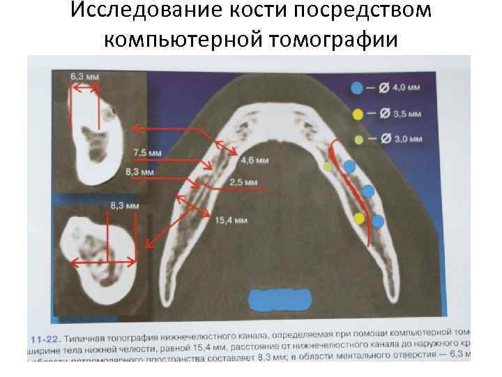 Исследование костей. Физиологическая подвижность зубов. Подвижность зубов по Энтину. Степени подвижности зубов по Евдокимову.