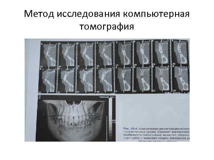 Метод исследования компьютерная томография 