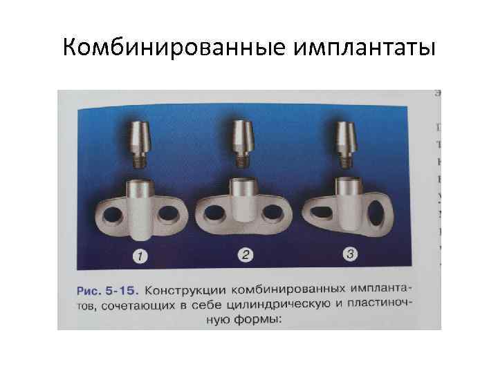 Комбинированные имплантаты 