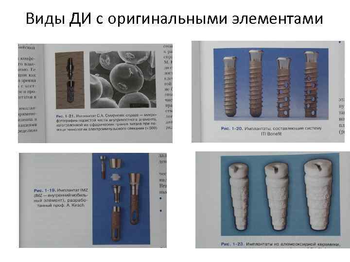 Виды ДИ с оригинальными элементами 