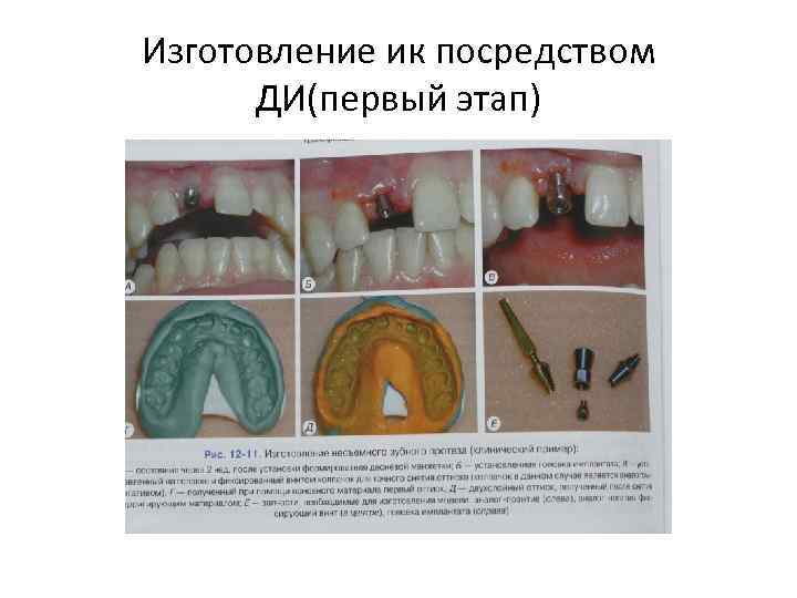 Изготовление ик посредством ДИ(первый этап) 