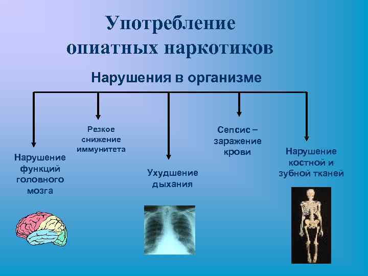 Употребление опиатных наркотиков Нарушения в организме Нарушение функций головного мозга Сепсис – заражение крови