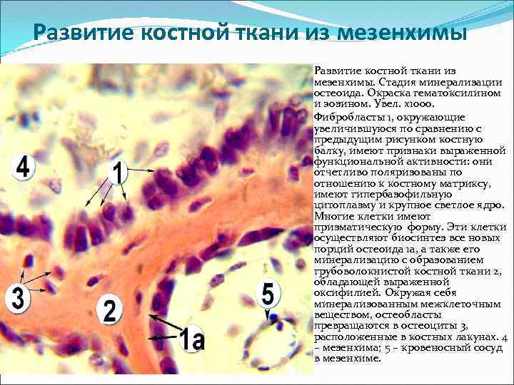 Мезенхима