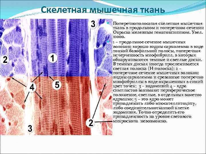 Скелетные мышцы ткань. Сарколемма скелетной мышечной ткани. Поперечнополосатая Скелетная мышечная ткань Железный гематоксилин. Поперечнополосатая Скелетная мышечная ткань продольный разрез. Скелетная поперечнополосатая мышечная ткань продольный срез.