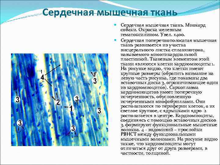 Сердечная мышечная ткань Сердечная мышечная ткань. Миокард собаки. Окраска железным гематоксилином. Увел. х400. Сердечная