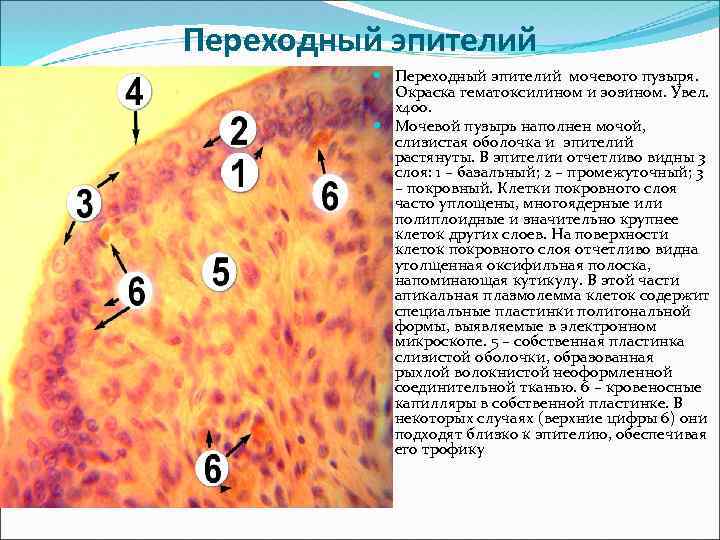 Переходный эпителий мочевого пузыря. Окраска гематоксилином и эозином. Увел. х400. Мочевой пузырь наполнен мочой,