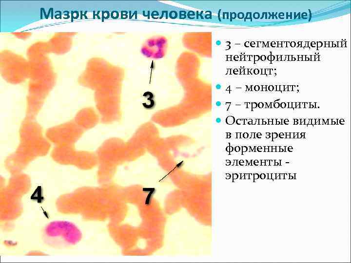 Мазрк крови человека (продолжение) 3 – сегментоядерный нейтрофильный лейкоцт; 4 – моноцит; 7 –