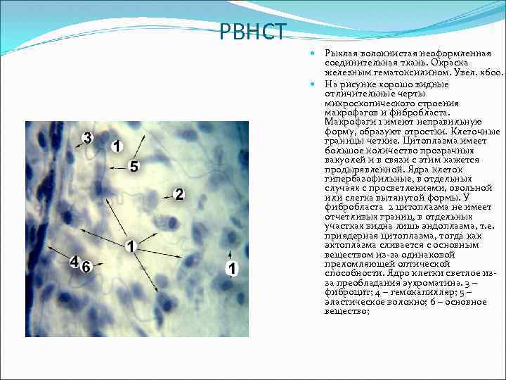 Рыхлая волокнистая неоформленная соединительная ткань рисунок