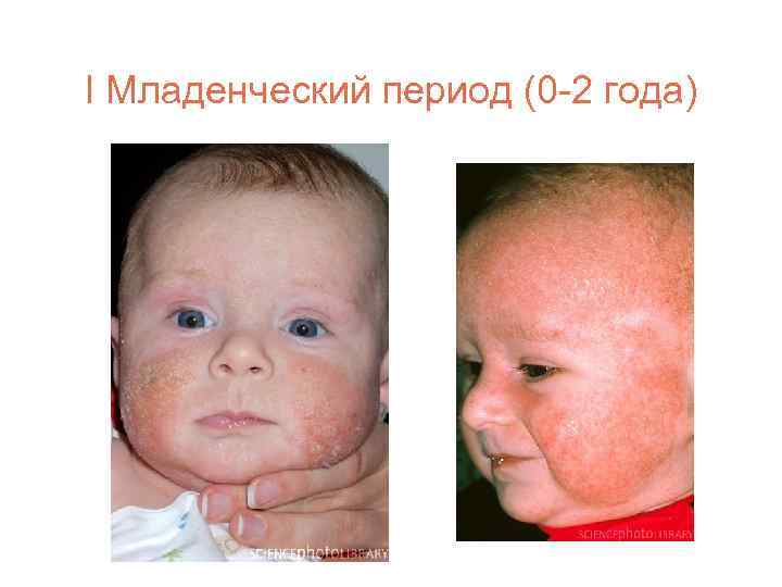 I Младенческий период (0 -2 года) 