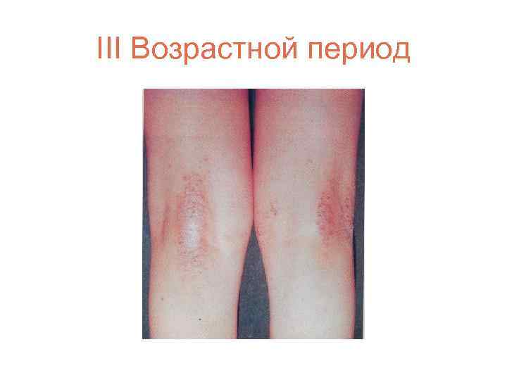 III Возрастной период 