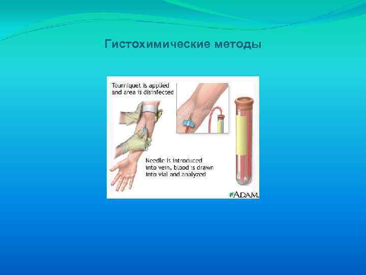 Гистохимические методы 
