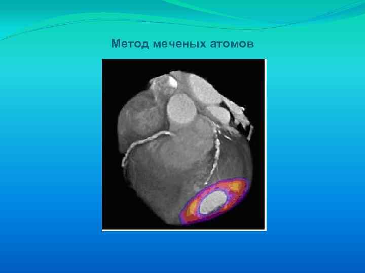 Метод меченых атомов презентация