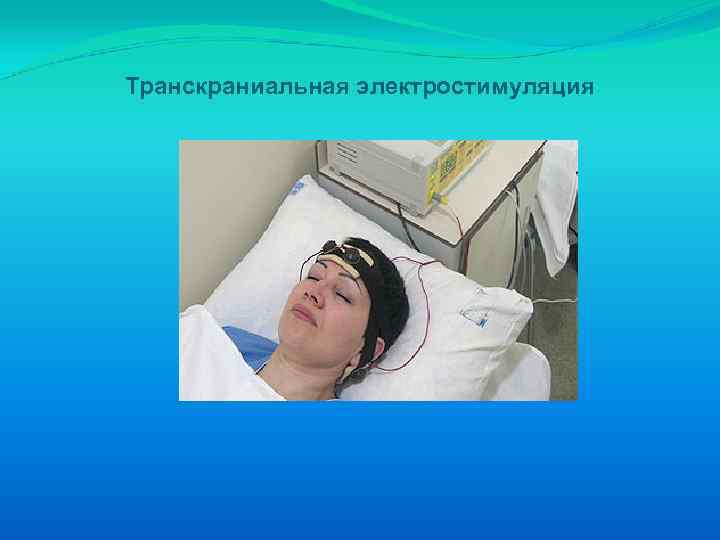 Транскраниальная электростимуляция 