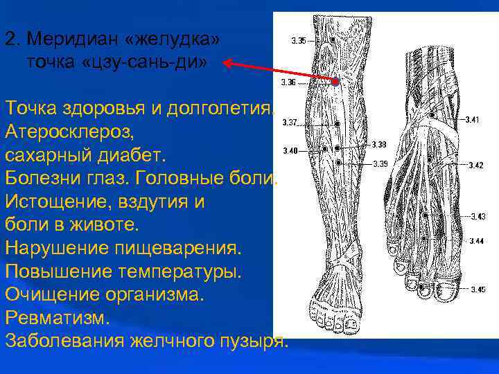 2. Меридиан «желудка» точка «цзу-сань-ди» Точка здоровья и долголетия. Атеросклероз, сахарный диабет. Болезни глаз.