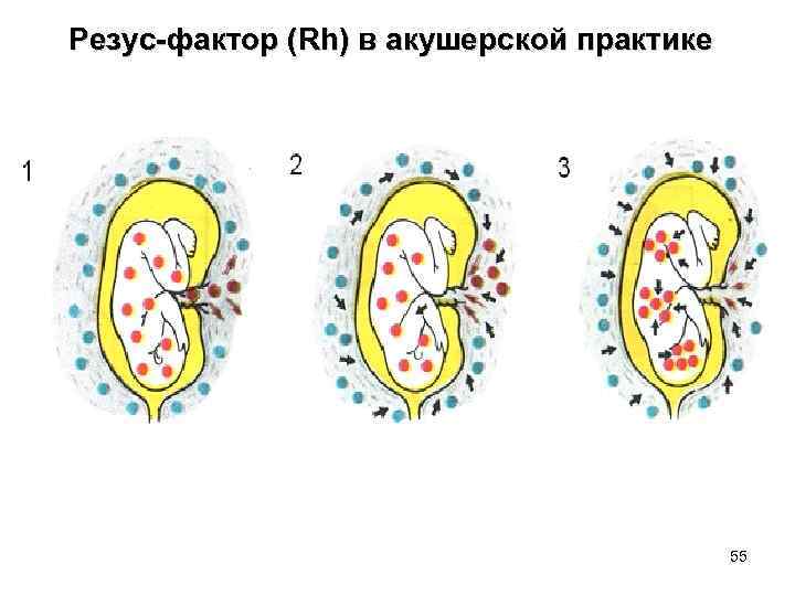 Резус-фактор (Rh) в акушерской практике 55 
