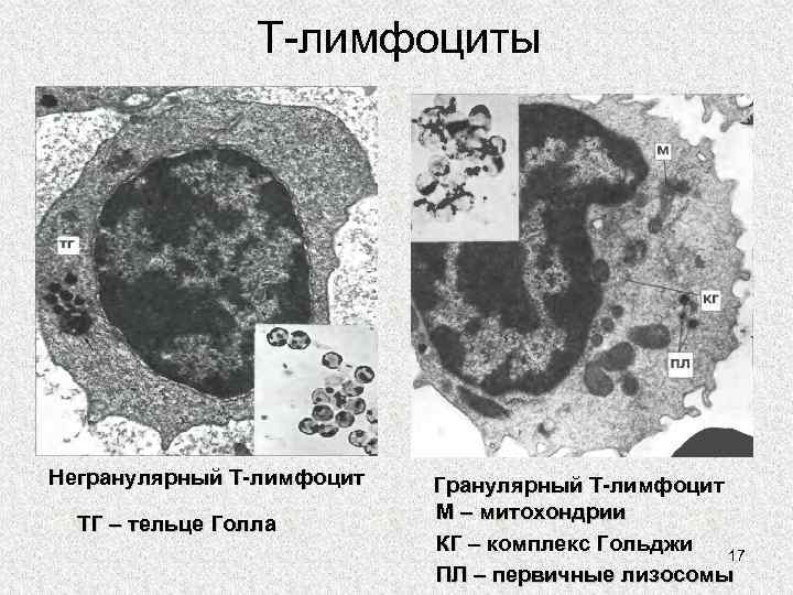 Т-лимфоциты Негранулярный Т-лимфоцит ТГ – тельце Голла Гранулярный Т-лимфоцит М – митохондрии КГ –