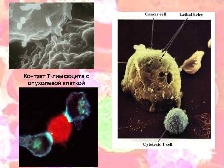 Контакт Т-лимфоцита с опухолевой клеткой 19 