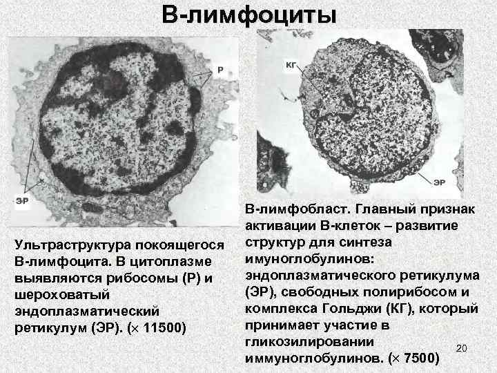 В-лимфоциты Ультраструктура покоящегося В-лимфоцита. В цитоплазме выявляются рибосомы (Р) и шероховатый эндоплазматический ретикулум (ЭР).