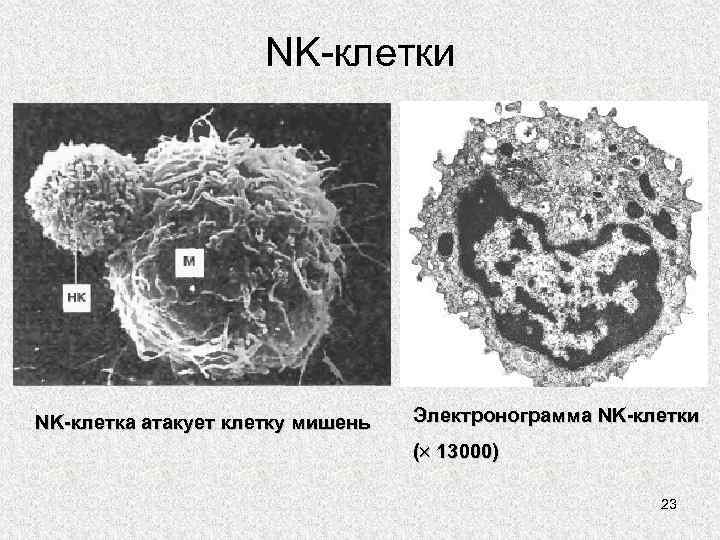 NK-клетки NK-клетка атакует клетку мишень Электронограмма NK-клетки ( 13000) 23 