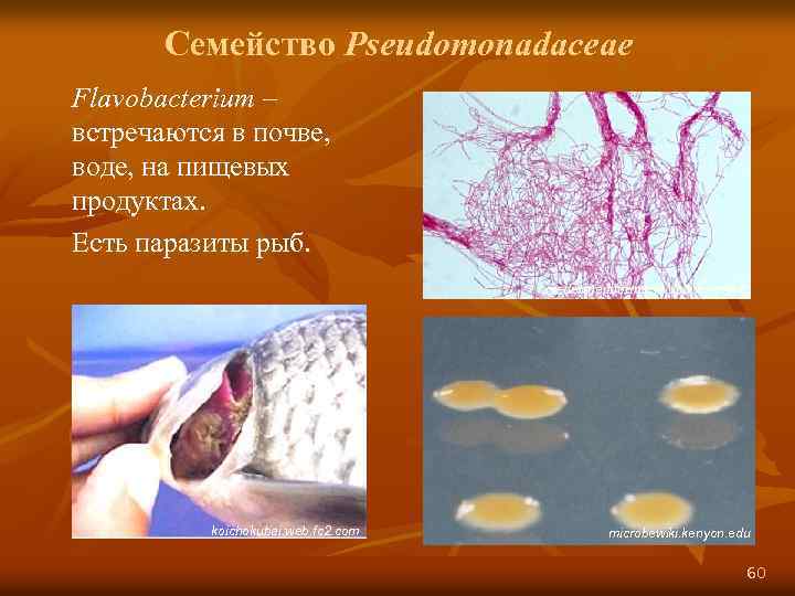 Семейство Pseudomonadaceae Flavobacterium – встречаются в почве, воде, на пищевых продуктах. Есть паразиты рыб.