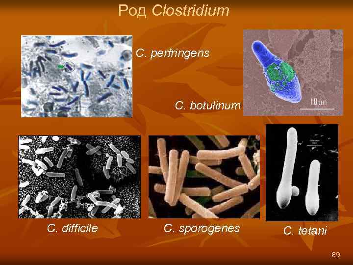 Род Clostridium C. perfringens C. botulinum C. difficile C. sporogenes C. tetani 69 