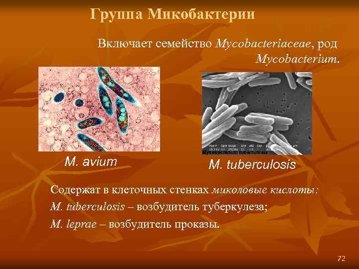 Туберкулез презентация по микробиологии