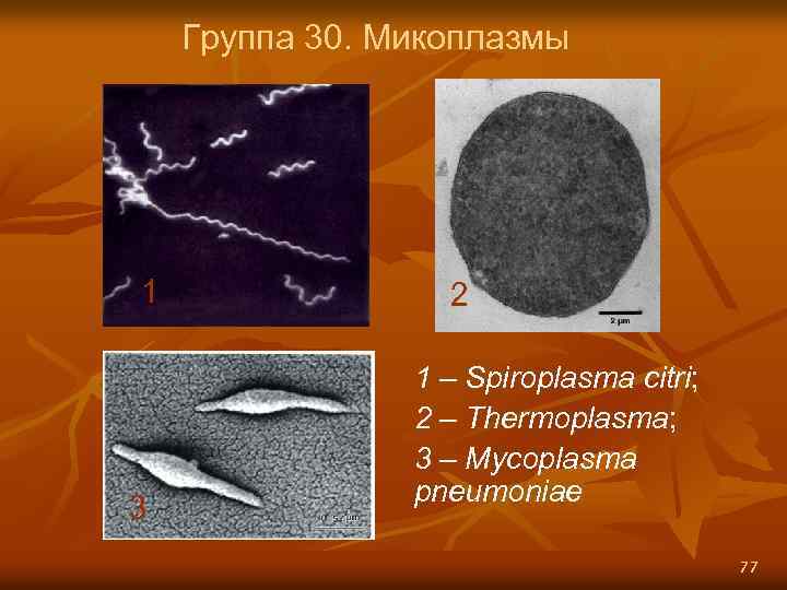 Группа 30. Микоплазмы 1 3 2 1 – Spiroplasma citri; 2 – Thermoplasma; 3