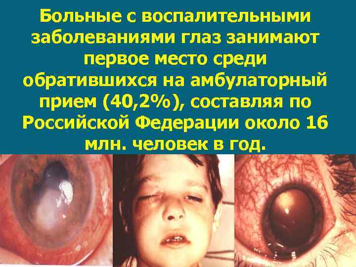 Больные с воспалительными заболеваниями глаз занимают первое место среди обратившихся на амбулаторный прием (40,