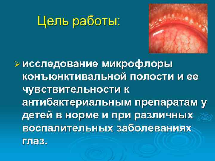 Цель работы: Ø исследование микрофлоры конъюнктивальной полости и ее чувствительности к антибактериальным препаратам у