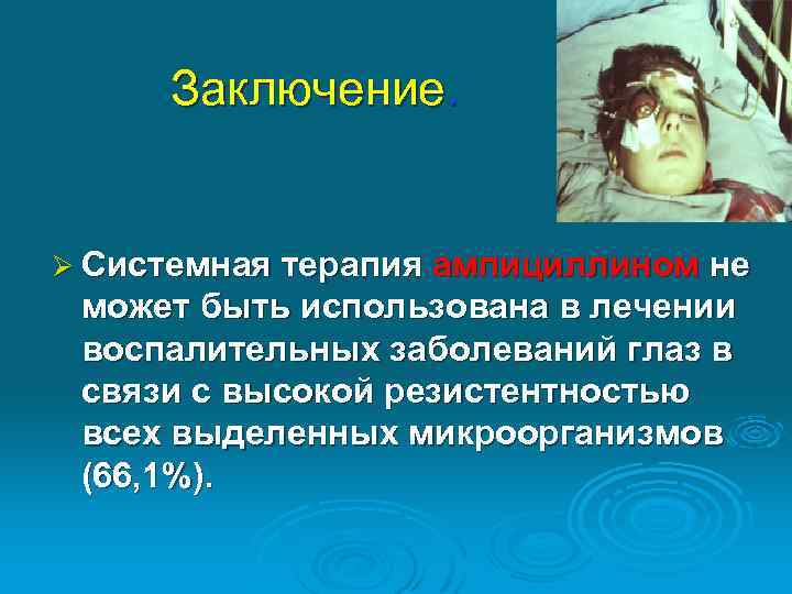 Заключение. Ø Системная терапия ампициллином не может быть использована в лечении воспалительных заболеваний глаз