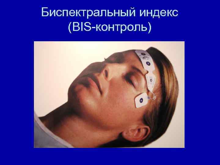 Биспектральный индекс (BIS-контроль) 