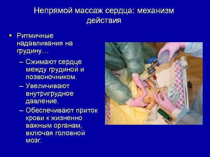 Непрямой массаж сердца: механизм действия § Ритмичные надавливания на грудину… – Сжимают сердце между