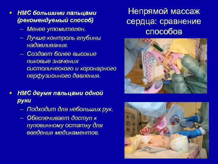§ НМС большими пальцами (рекомендуемый способ) – Менее утомителен. – Лучше контроль глубины надавливания.