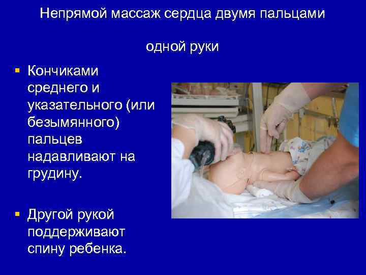 Непрямой массаж сердца двумя пальцами одной руки § Кончиками среднего и указательного (или безымянного)