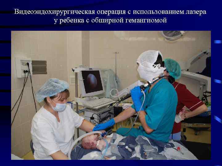 Видеоэндохирургическая операция с использованием лазера у ребенка с обширной гемангиомой 