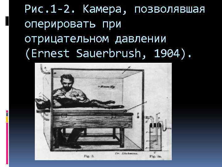 Рис. 1 -2. Камера, позволявшая оперировать при отрицательном давлении (Ernеst Sauerbrush, 1904). 