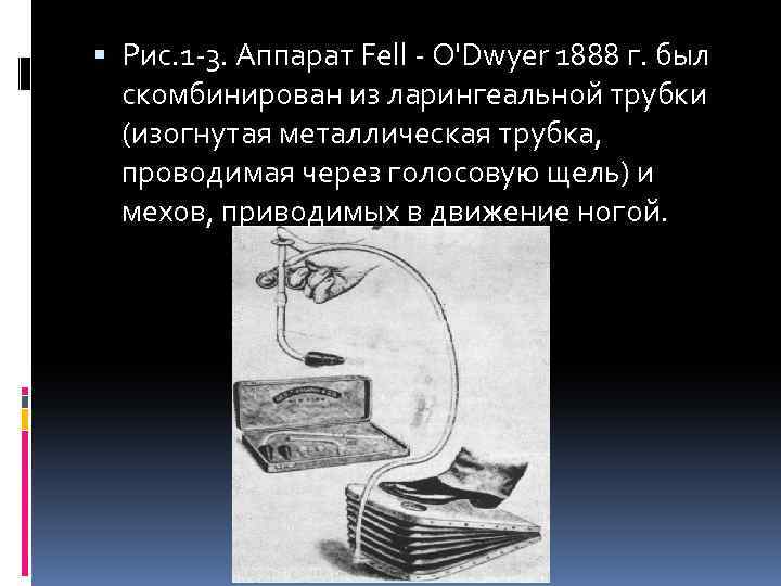  Рис. 1 -3. Аппарат Fell - O'Dwyer 1888 г. был скомбинирован из ларингеальной