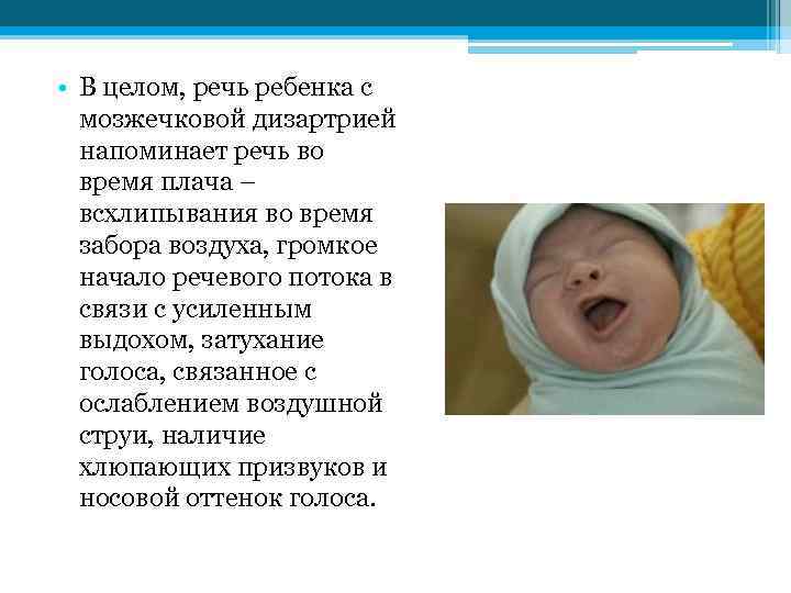  • В целом, речь ребенка с мозжечковой дизартрией напоминает речь во время плача