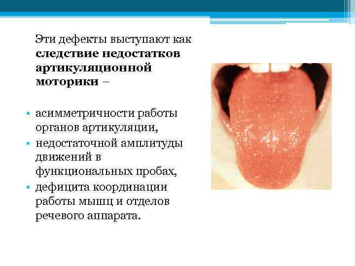Эти дефекты выступают как следствие недостатков артикуляционной моторики – • асимметричности работы органов артикуляции,