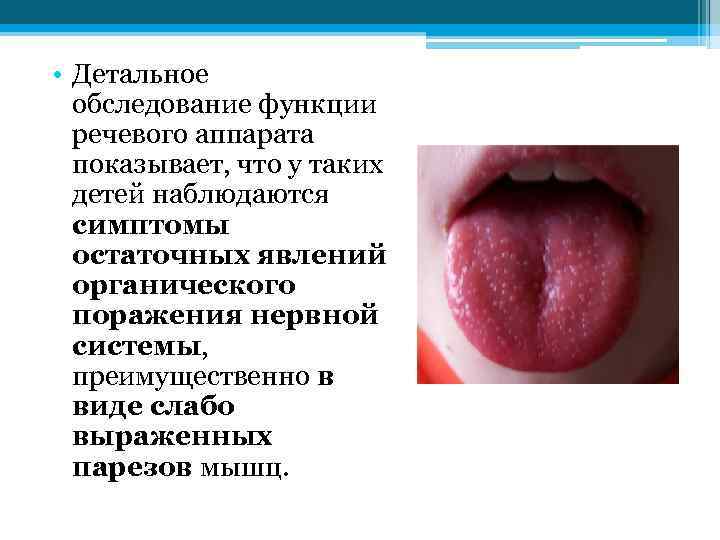  • Детальное обследование функции речевого аппарата показывает, что у таких детей наблюдаются симптомы