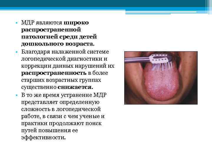  • МДР являются широко распространенной патологией среди детей дошкольного возраста. • Благодаря налаженной