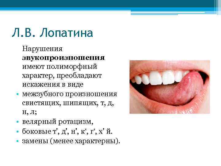 Л. В. Лопатина • • Нарушения звукопроизношения имеют полиморфный характер, преобладают искажения в виде
