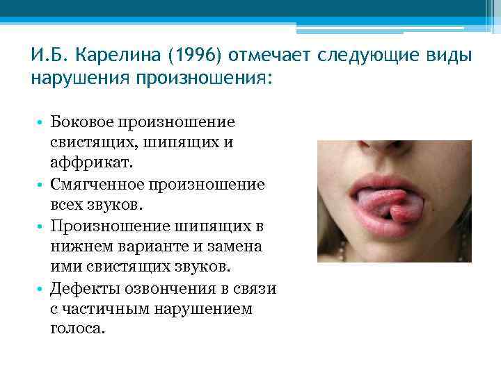 И. Б. Карелина (1996) отмечает следующие виды нарушения произношения: • Боковое произношение свистящих, шипящих